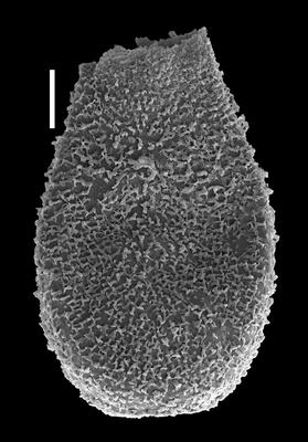 <i><i>Acanthochitina</i> | Acanthochitina sp. A</i><br />Likenai 396 borehole, 792.06 m, Porkuni Stage (884-15)