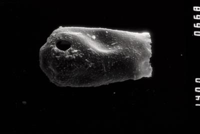 <i><i>Conochitina</i> | Conochitina? sp.</i><br />Dubovskoye borehole, 1205.00 m, Kuressaare Stage (754-1316)