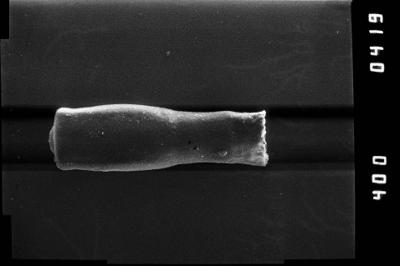 <i><i>Conochitina</i> | Conochitina sp. 2</i><br />Kirikuküla borehole, 47.90 m, Adavere Stage (754-1186)