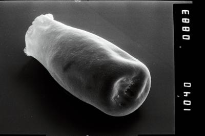 <i><i>Conochitina</i> | Conochitina sp.5 </i><br />Vängla trench,  m, Adavere Stage (754-1939)