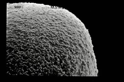 <i><i>Conochitina</i> | Conochitina sp.</i><br />Tartu 509 borehole, 188.70 m, Juuru Stage (754-505)