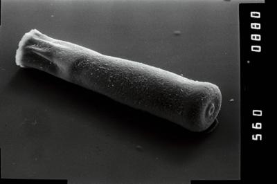 <i><i>Conochitina</i> | Conochitina sp.</i><br />Käru 401 puurauk, 114.00 m, Raikküla Stage (754-1936)