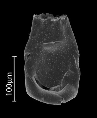 <i><i>Eisenackitina</i></i><br />Bebirva 111 borehole, 1127.95 m, Ludfordian (902-14)