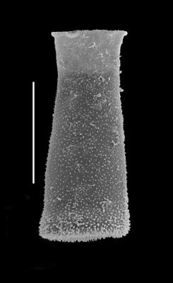<i><i>Belonechitina micracantha</i> | Belonechitina micracantha (Eisenack)</i><br />Black Knob Ridge Section,  m, Katian (862-16)