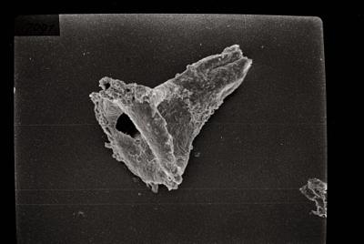 <i><i>Ancyrochitina</i> | Ancyrochitina sp.</i><br />Ikla borehole, 305.50 m, Adavere Stage (754-151)