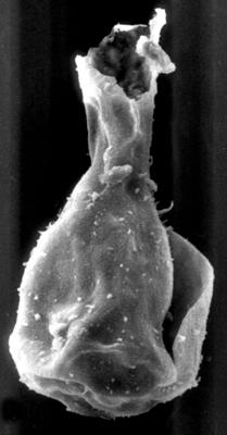 <i><i>Chitinozoa</i> | Sphaerochitina? sp. 2 Nestor, 1994</i><br />Ohesaare borehole, 161.20 m, Jaagarahu Stage (272-205)