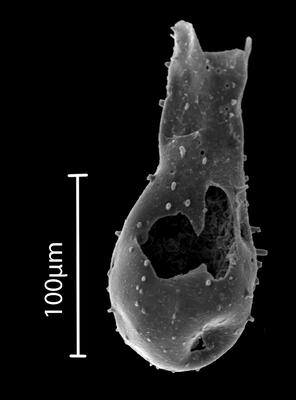 <i><i>Ramochitina</i></i><br />Bebirva 111 borehole, 1105.65 m, Ludfordian (902-53)