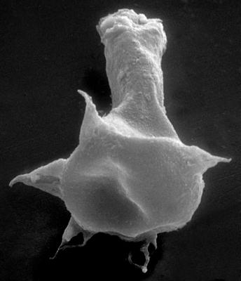<i><i>Chitinozoa</i> | Plectochitina cf. pachyderma Laufeld, 1974</i><br />Ruhnu 500 borehole, 359.25 m, Jaagarahu Stage (272-48)