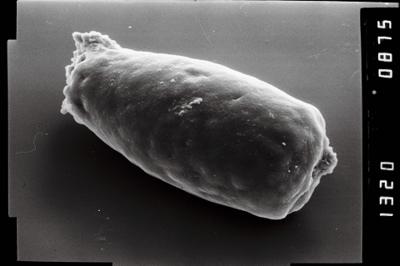 <i><i>Conochitina</i> | Conochitina sp.</i><br />Viluvere 324 borehole, 51.70 m, Adavere Stage (754-1931)