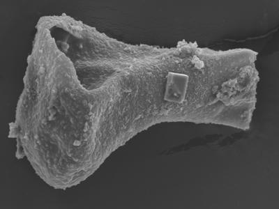 <i><i>Sphaerochitina lycoperdoides</i></i><br />Ohesaare borehole, 152.90 m, Rootsiküla Stage (754-349)