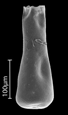 <i><i>Conochitina</i> | Conochitina sp.</i><br />Bebirva 111 borehole, 1121.05 m, Ludfordian (902-1)