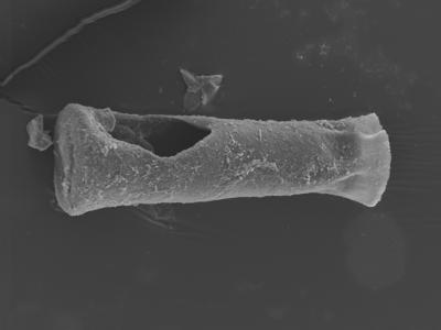 <i><i>Conochitina</i> | Conochitina sp. n</i><br />Ohesaare borehole, 162.00 m, Jaagarahu Stage (754-338)