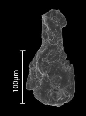 <i><i>Angochitina</i></i><br />Bebirva 111 borehole, 1080.30 m, Ludfordian (902-47)