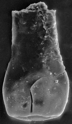 <i><i>Vitreachitina</i> | Vitreachitina sp. 2 Nestor, 1994</i><br />Nagli 106 borehole, 625.10 m, Adavere Stage (272-195)