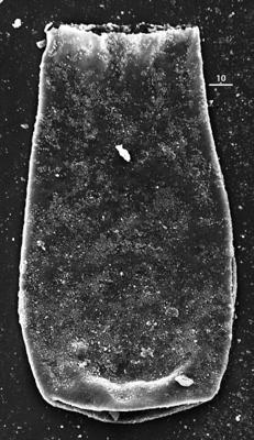 <i><i>Conochitina visbyensis</i></i><br />Aizpute 41 borehole, 964.60 m, lower Silurian (345-20)