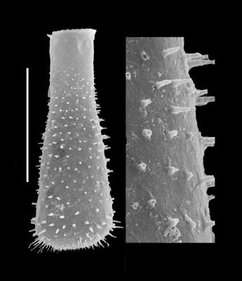 <i><i>Belonechitina wesenbergensis elongata</i> | Belonechitina wesenbergensis elongata (Eisenack)</i><br />Black Knob Ridge Section,  m, Katian (862-31)
