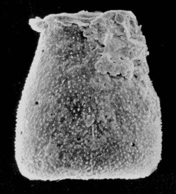 <i><i>Chitinozoa</i> | Eisenackitina sp. 1 Nestor, 1994</i><br />Ohesaare borehole, 342.20 m, Jaani Stage (272-172)