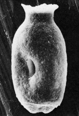 <i><i>Desmochitina papilla</i></i><br />Suhkrumägi outcrop,  m, Volkhov Stage (357-43)