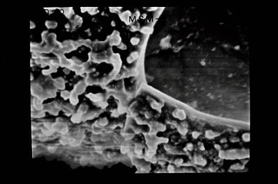 <i><i>Conochitina</i> | Conochitina sp.</i><br />Ruhnu 500 borehole, 344.50 m, Jaagarahu Stage (754-667)