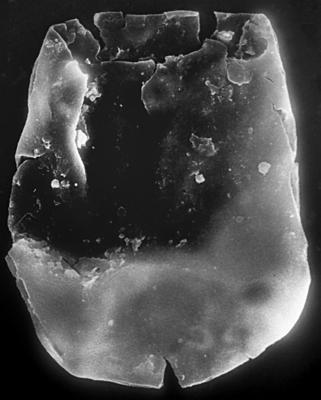 <i><i>Chitinozoa</i> | Eisenackitina? sp. 3 Nestor, 1994</i><br />Häädemeeste 172 borehole, 311.23 m, Raikküla Stage (272-176)