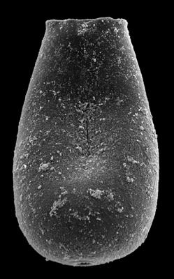 <i><i>Eisenackitina</i> | Eisenackitina sp. A Loydell et al., 2010</i><br />Kolka 54 borehole, 459.10 m, Jaagarahu Stage (546-89)