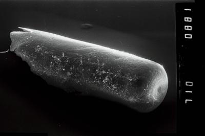 <i><i>Conochitina</i> | Conochitina sp.</i><br />Ikla borehole, 323.40 m, Raikküla Stage (754-1937)