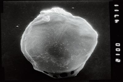 <i><i>Ancyrochitina</i> | Ancyrochitina sp.</i><br />Viki borehole, 148.45 m, Adavere Stage (754-1122)