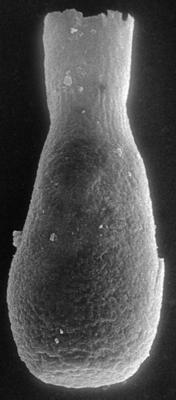 <i><i>Chitinozoa</i> | Lagenochitina? sp.</i><br />Nagli 106 borehole, 676.00 m, Juuru Stage (272-198)
