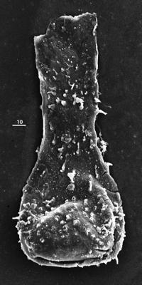 <i><i>Ramochitina ruhnuensis</i></i><br />Aizpute 41 borehole, 937.50 m, lower Silurian (345-29)