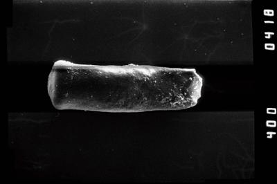 <i><i>Conochitina</i> | Conochitina sp. 2</i><br />Kirikuküla borehole, 47.90 m, Adavere Stage (754-1187)