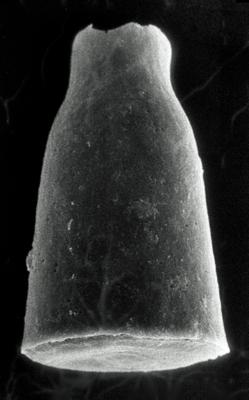 <i><i>Chitinozoa</i> | Cyathochitina cf. calix (Eisenack, 1931)</i><br />Rapla borehole, 114.80 m, Rakvere Stage (190-11)