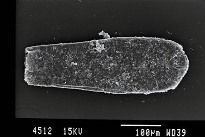 <i><i>Conochitina</i> | Conochitina sp. ???</i><br />Gussev 1 borehole, Kaliningrad oblast, 1467.80 m, Rootsiküla Stage (754-11)