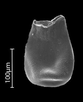 <i><i>Eisenackitina</i></i><br />Bebirva 111 borehole, 1127.95 m, Ludfordian (902-13)