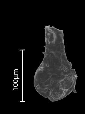 <i><i>Ramochitina</i></i><br />Bebirva 111 borehole, 1087.60 m, Ludfordian (902-51)