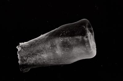 <i><i>Conochitina</i> | Conochitina sp. (H)</i><br />Ruhnu 500 borehole, 465.40 m, Adavere Stage (754-797)