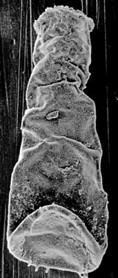 <i><i>Spinachitina fragilis</i></i><br />Ohesaare borehole, 446.50 m, Juuru Stage (212-17)