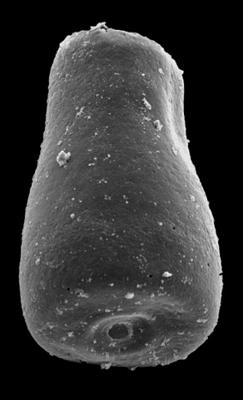 <i><i>Conochitina</i> | Conochitina sp. b Loydell et al., 2010</i><br />Kolka 54 borehole, 455.40 m, Jaagarahu Stage (546-86)