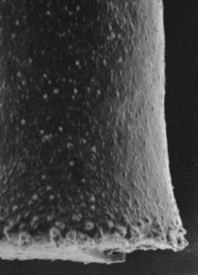<i><i>Spinachitina coronata</i> | Coronochitina coronata Eisenack, 1931</i><br />Hagudi borehole, 35.50 m, Pirgu Stage (306-9)