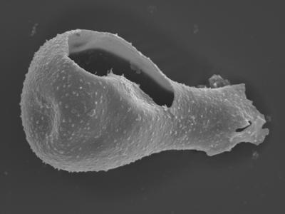 <i><i>Sphaerochitina lycoperdoides</i></i><br />Ohesaare borehole, 147.60 m, Rootsiküla Stage (754-361)