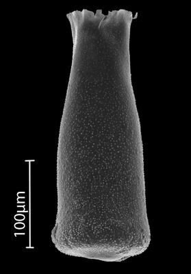 <i><i>Eisenackitina</i></i><br />Bebirva 111 borehole, 1024.45 m, Ludfordian (902-15)