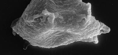 <i><i>Chitinozoa</i> | Plectochitina cf. pachyderma Laufeld, 1974</i><br />Ruhnu 500 borehole, 359.25 m, Jaagarahu Stage (272-49)