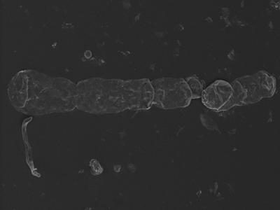 <i><i>Chitinozoa</i></i><br />Kolka 54 borehole, 533.00 m, Jaani Stage (754-1225)