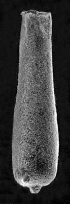 <i><i>Chitinozoa</i> | Conochitina aff. flamma Laufeld, 1974</i><br />Mustjala borehole, 57.20 m, Jaani Stage (220-19)