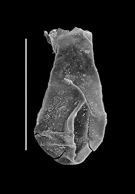 <i><i>Lagenochitina</i> | Lagenochitina aff. L. dalbyensis (Laufeld)</i><br />Black Knob Ridge Section,  m, Katian (862-9)