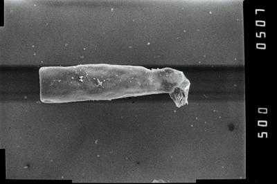 <i><i>Conochitina</i> | Conochitina sp. 4</i><br />Kirikuküla borehole, 47.90 m, Adavere Stage (754-1185)