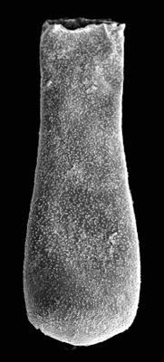 <i><i>Belonechitina mortimerensis</i></i><br />Pavilosta 51 borehole, 749.00 m, Gorstian (576-18)