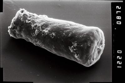 <i><i>Conochitina</i> | Conochitina sp.</i><br />Viluvere 324 borehole, 51.70 m, Adavere Stage (754-1929)