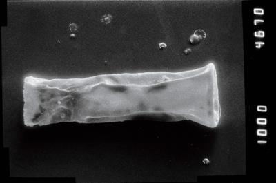 <i><i>Conochitina</i> | Conochitina sp. 4</i><br />Puikule 42 borehole, 331.50 m, Adavere Stage (754-1106)