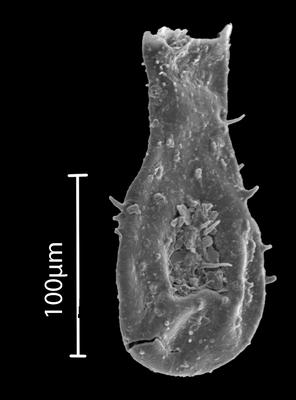 <i><i>Ramochitina</i></i><br />Bebirva 111 borehole, 1105.65 m, Ludfordian (902-52)