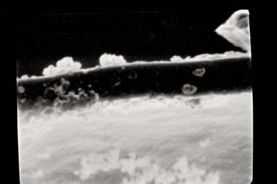 <i><i>Conochitina</i> | Conochitina sp.</i><br />Laeva 10 borehole, 90.40 m, Juuru Stage (754-482)